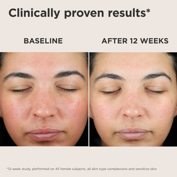 UV Skin Recovery SPF 50