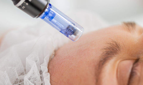 "Frighteningly Flawless" Package- 3 Sessions (1 FREE Microneedling & Stimulator Peel)